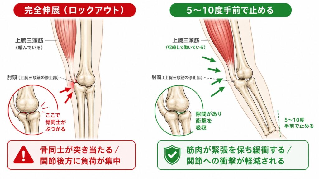 肘を完全伸展（ロックアウト）した時と5〜10度手前で止めた時の関節負荷の比較図。完全伸展では肘頭で骨同士が突き当たり負荷が集中するのに対し、手前で止めると上腕三頭筋が緩衝する
